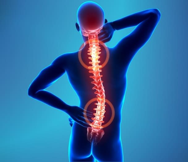 Tratamento de Coluna