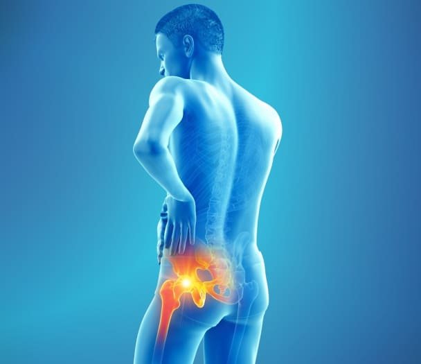 Tratamento de Quadril